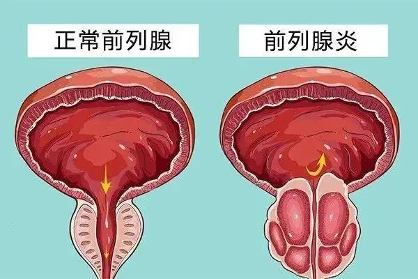 丹东前列腺治得不错的医院，来丹东国丹医院